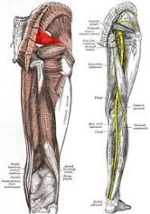 PIRIFORMIS SYNDROME (PAIN in the BUTT)